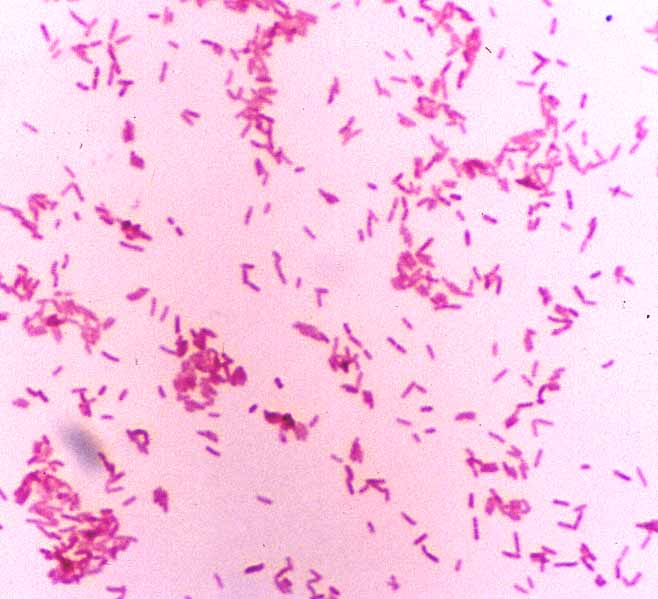 Bordetella bronchiseptica   lookfordiagnosis.com